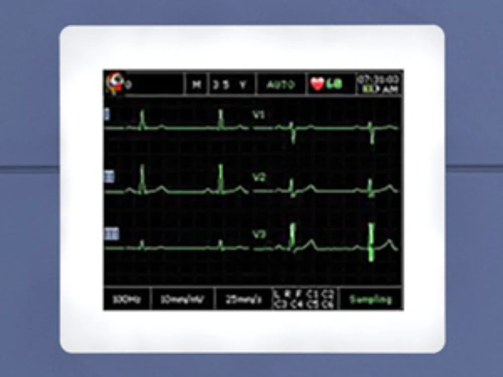 Edan VE-300 3-Channel Veterinary ECG Machine
